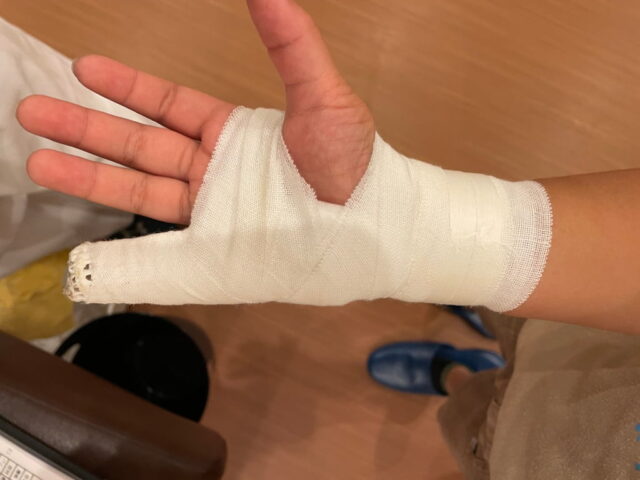 施術の写真